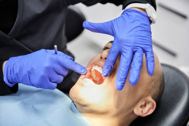Best Chipped Tooth Repair Near Me  in Hillsborough, CA